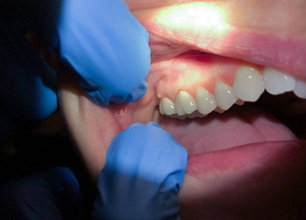 Best Mobile Emergency Dentist in Eton, GA